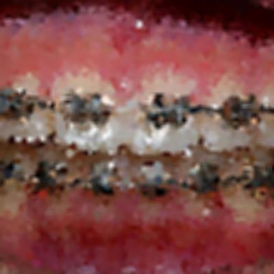 Level 35 Answer 10 - dental braces